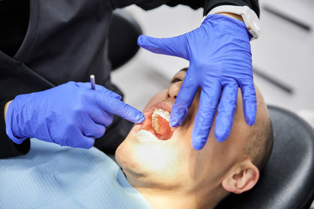 Best Emergency Dental Extractions in Window Rock, AZ